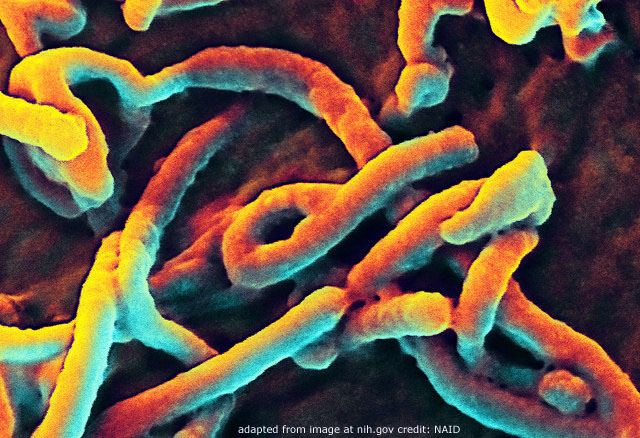 Ebola Virus, adapted from image at nih.gov with credit NAID